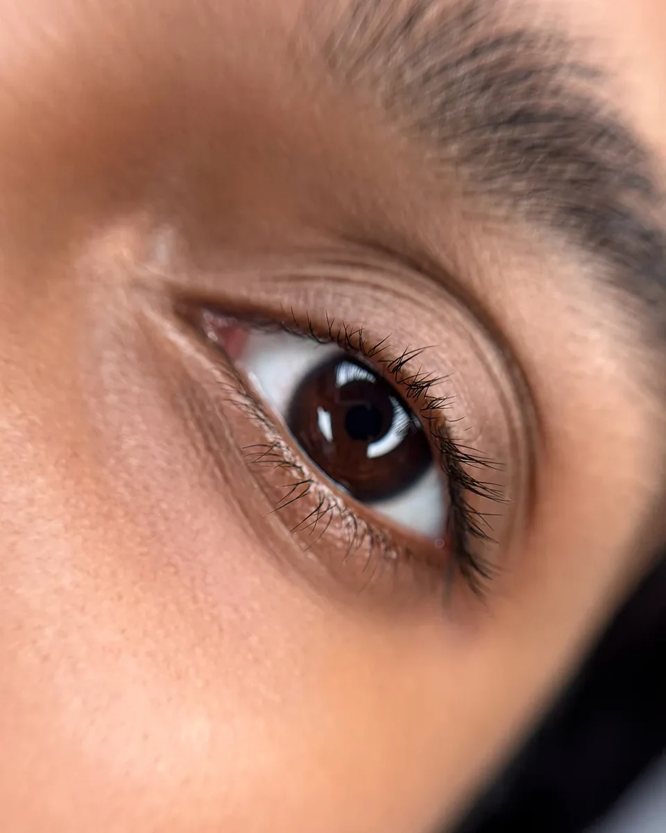 Before Lash line enhancement