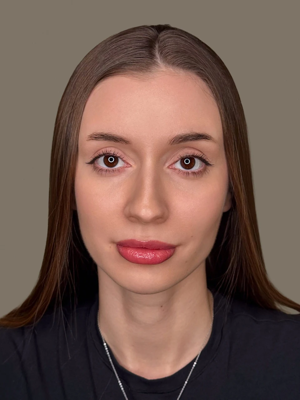 Before Combo brows treatment by Elina