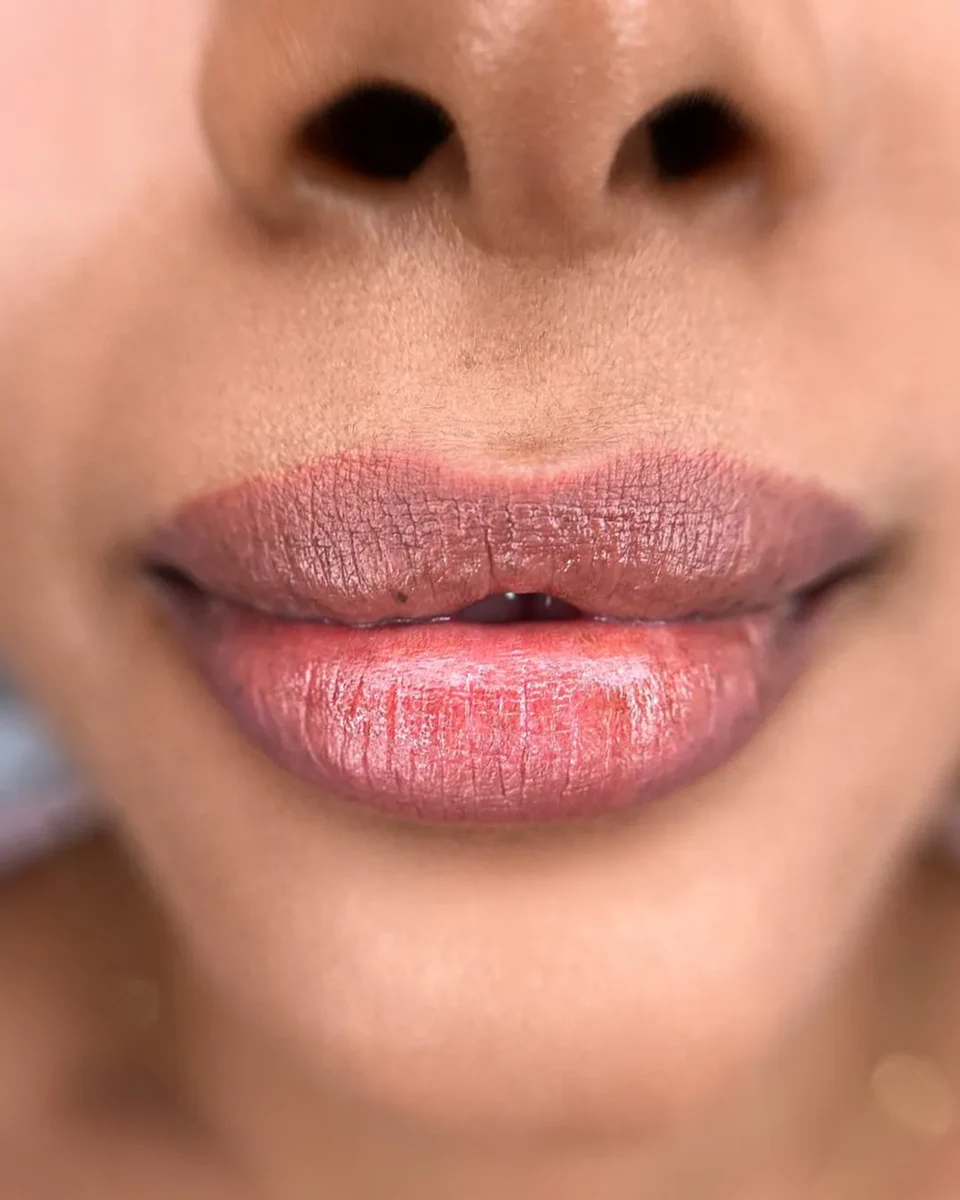 Lip neutralization result by Elina