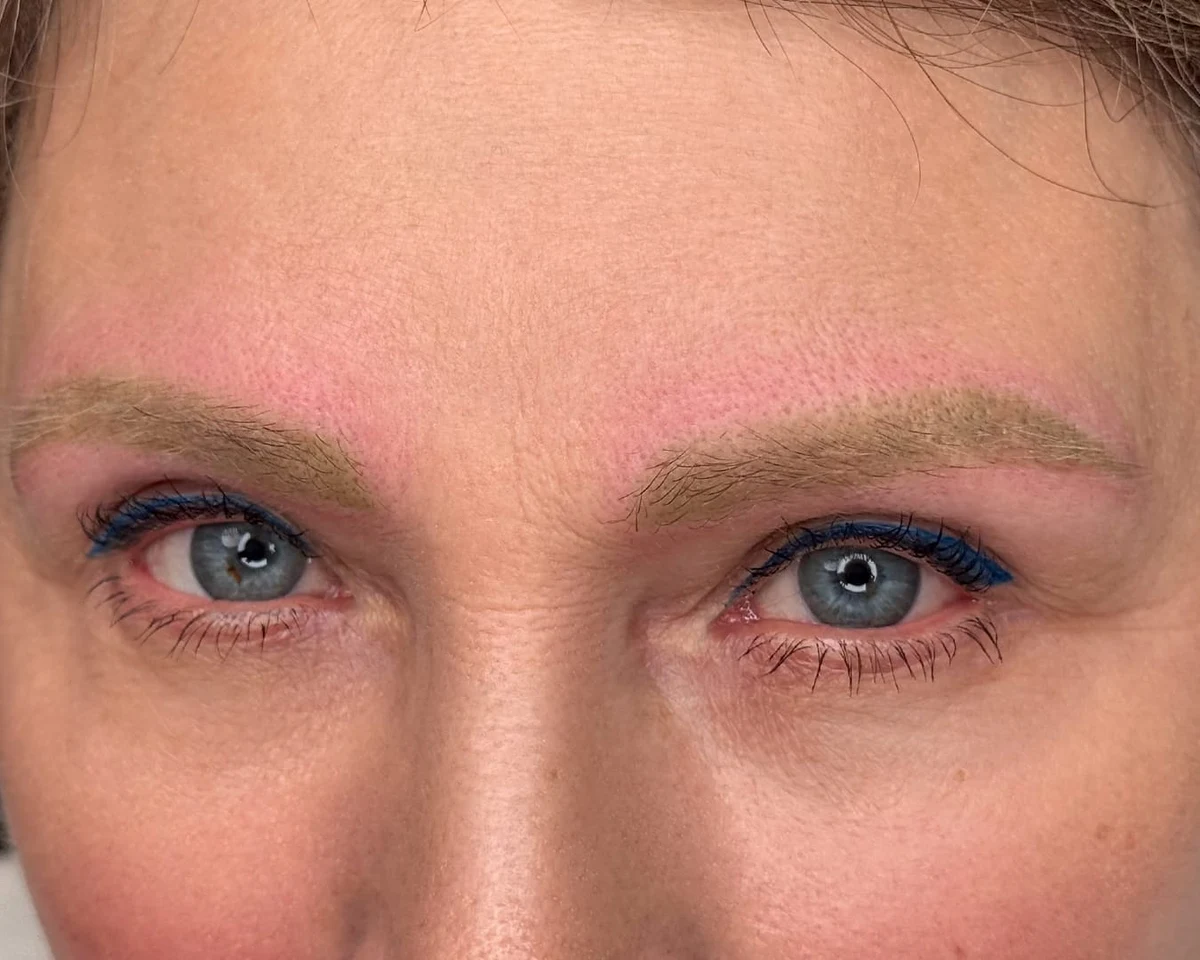 After brow pigment removal progress by Elina, portfolio example 2