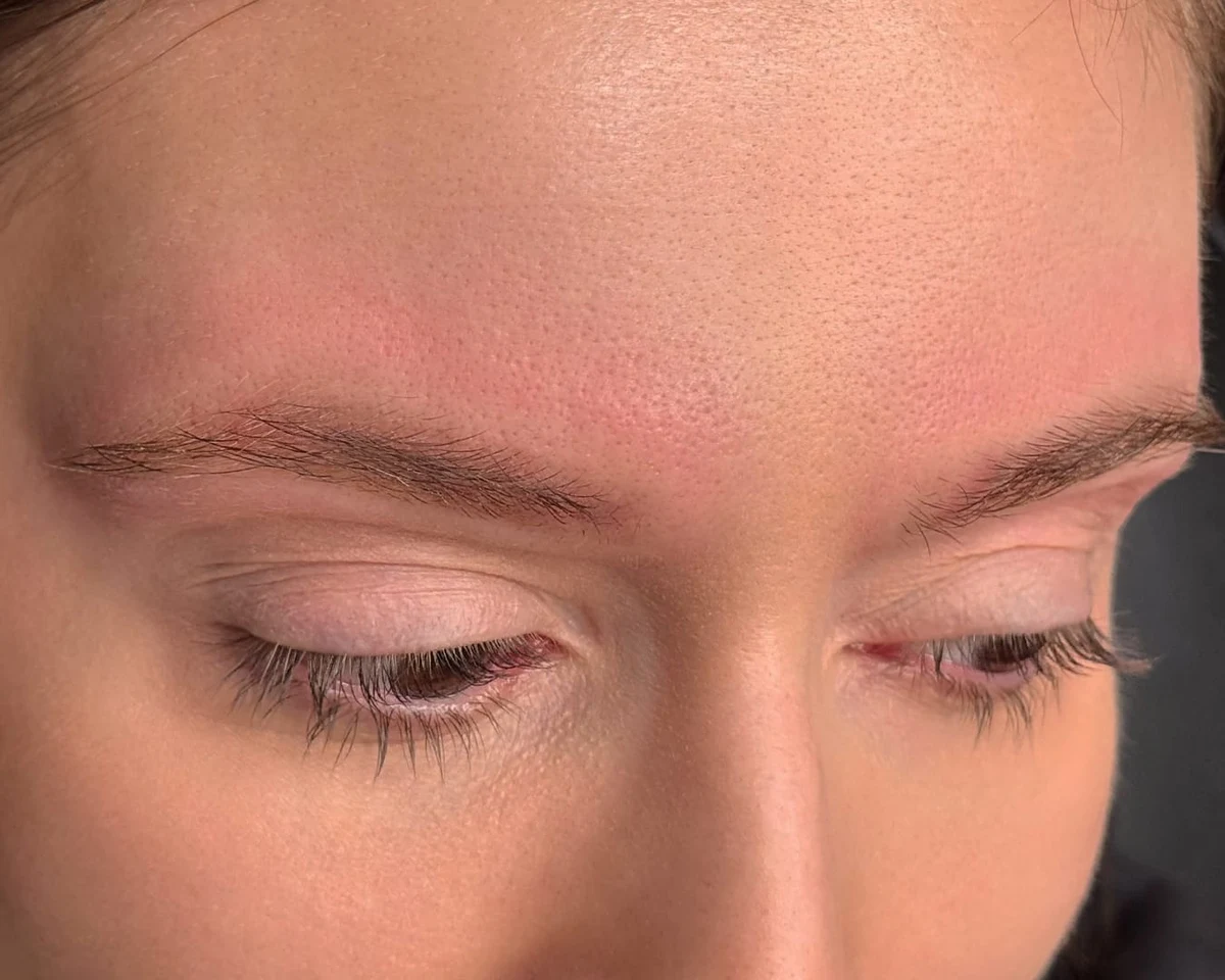 After brow pigment removal progress by Elina, portfolio example 3
