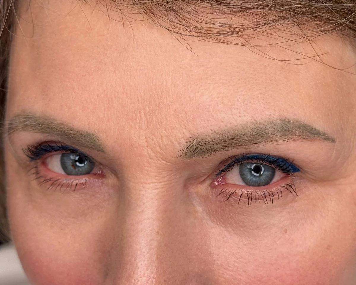 Before brow pigment removal progress by Elina, portfolio example 2