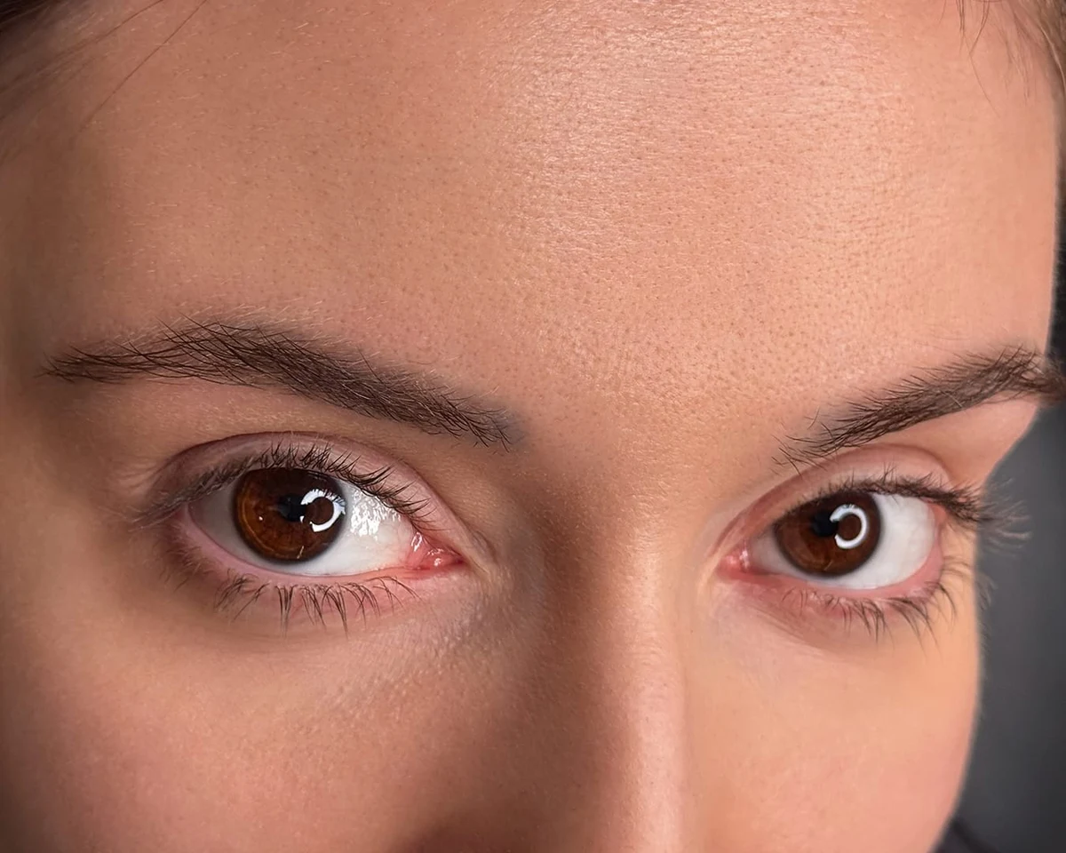 Before brow pigment removal progress by Elina, portfolio example 3